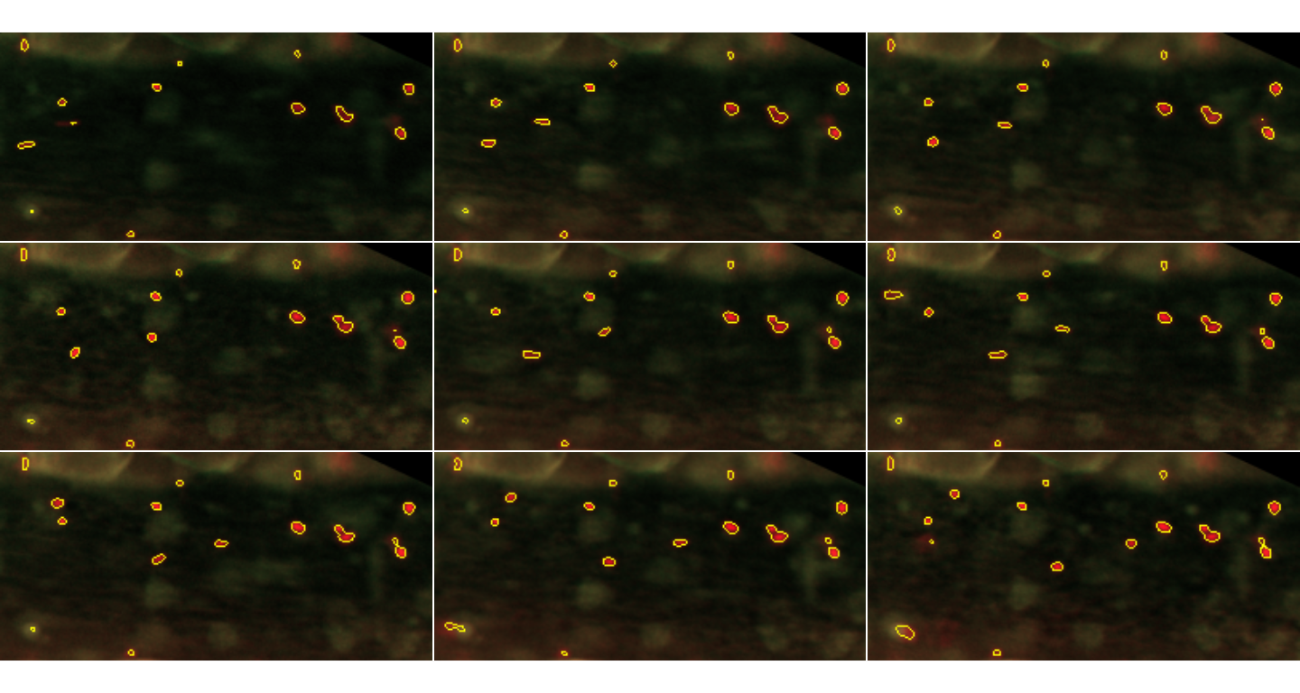 Particles detected in the first 9 frames. Particles detected in the first 9 frames are shown in yellow, with their contours defined by the segmentation procedure.